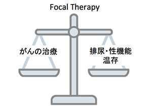 Focal Therapy